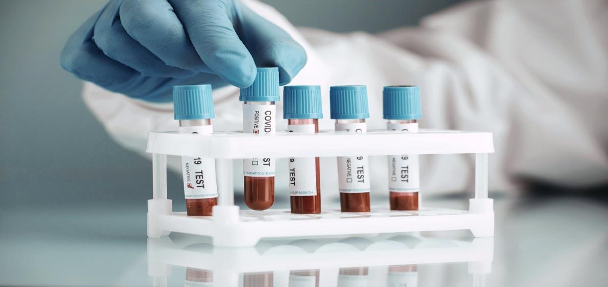 A gloved hand placing sample tubes in a rack